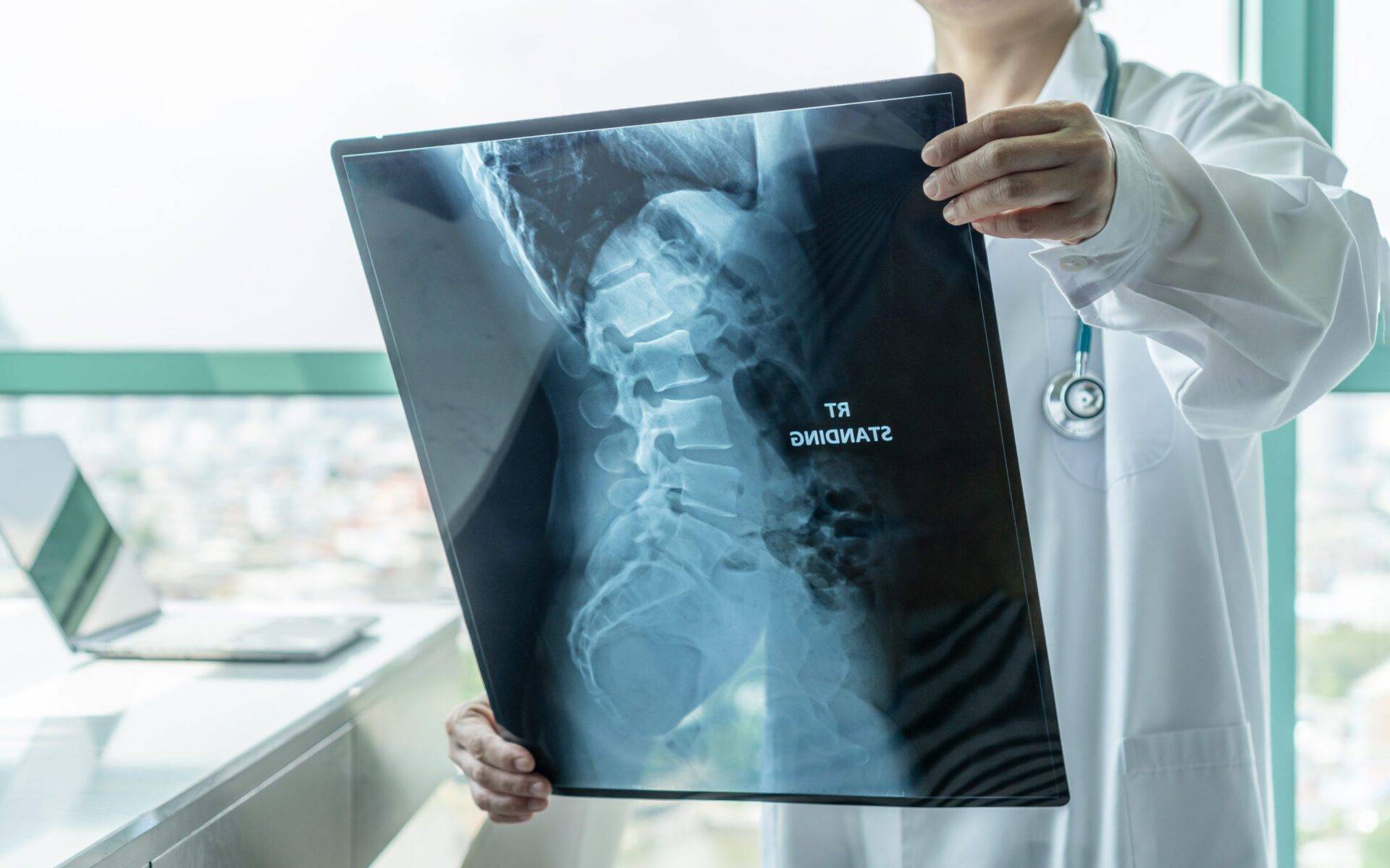 Doctor looking at radiological spinal x-ray film
