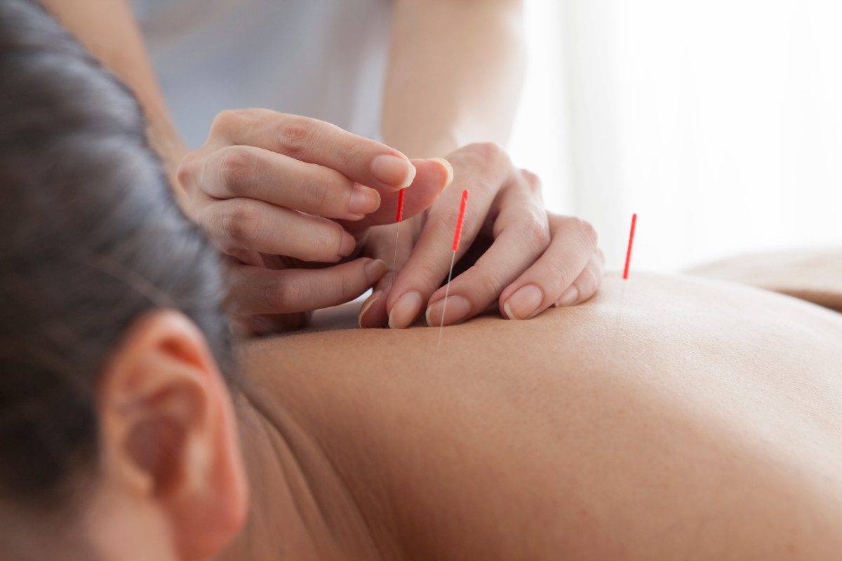 Women who are relaxed by receiving acupuncture on the neck