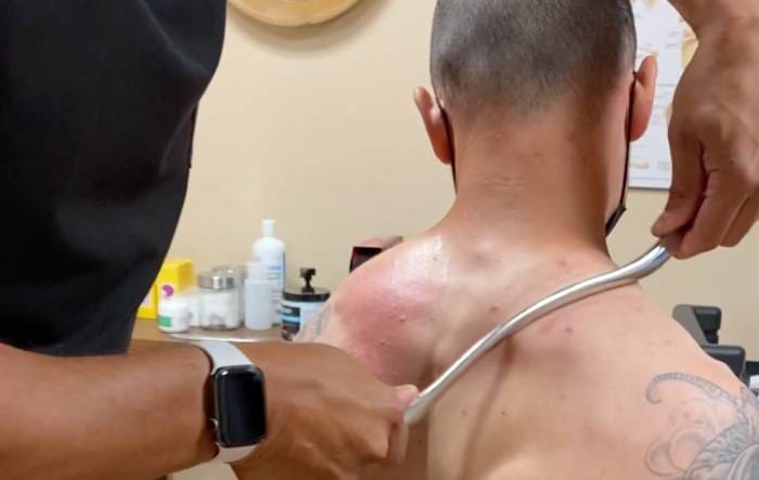 a man is getting his back scanned by a doctor